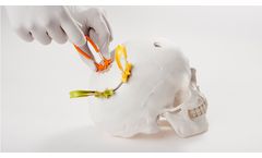 Model Cranial LOOP - Cranial Fixation Devices