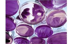 AEP - Microbiological Laboratory Service