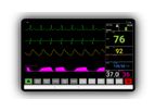 Clinical Monitors