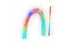 CFD Simulation