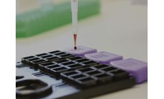 Randox - Biochip Array Technology
