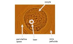 Brillouin IVF System
