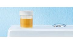 Urinary Tract Infections (UTIs) Services