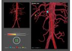 Simbionix - Endovascular Basic Skills Module