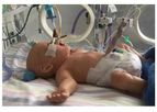 Lifecast - Model DDH BABY - Hip Dysplasia Examination Manikin