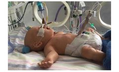 Lifecast - Model DDH BABY - Hip Dysplasia Examination Manikin