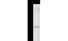 Croyez - Model IL-1 - Beta (Interleukin-1ß), Human Protein