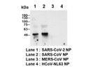 Croyez - Human Anti-SARS-CoV & CoV-2 NP Antibody (IgG)
