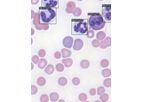 Hematology / General Pathology Service