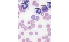 Hematology / General Pathology Service