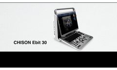 Chison Ebit 30Vet - Video