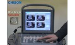 Chison ECO1 Vet - Video