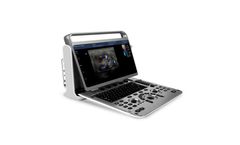 Chison - Model Ebit 30Vet - Light-Weight Ultrasound