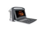 Chison - Model ECO2 VET - Portable Ultrasound