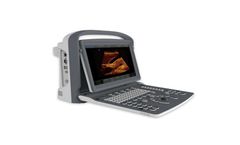 Chison - Model ECO2 VET - Portable Ultrasound