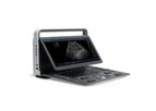 SonoScape - Model A6V Expert-E1V - Advanced B/W Ultrasound