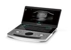 BCF - Model Vetus EQ - Portable And Practical Colour Doppler Ultrasound System