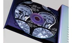 CD Import / Data Reconciliation