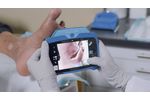 Standard Imaging of wounds with the MolecuLightDX - Video