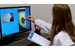 Workflow of MolecuLight i:X Telemedicine Solution for Wound Imaging - Video