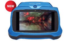 MolecuLightDX - Point-of-Care Wound Imaging Device