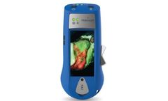 MolecuLight i:X - Wound Imaging Device
