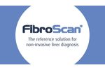 FibroScan Demonstration Exam - Video
