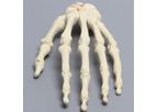 Sawbones - Model 1016-18 - Hand with Scaphoid Fracture and Ligament, Solid Foam
