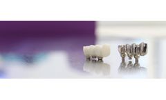 Panthera - Model Copywax - Panthera Implant Bridge