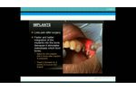 LLLT Presentation HD - Video