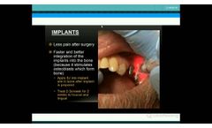 LLLT Presentation HD - Video