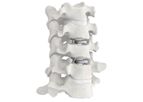 Model Mobi-C - Cervical Disc