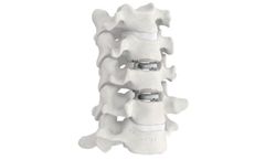 Model Mobi-C - Cervical Disc