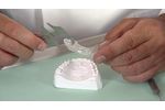 Simple Splint Therapy Utilizing Hard Soft Occlusal Splints - Video