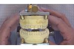 Chairside Live Episode 25: Esthetic Alternative to Traditional Retainers - Video