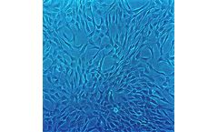Human Chondrocytes: HC