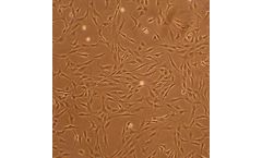 Human Chondrocytes: Osteoarthritis: HC-OA