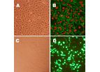 Human Aortic Endothelial Cells: HAOEC
