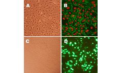 Human Aortic Endothelial Cells: HAOEC