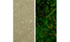 Human Brachiocephalic Artery Endothelial Cells: HBcAEC