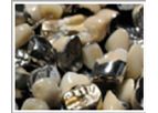 Dental Scrap Refining