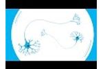 What Causes Parkinson`s? Video
