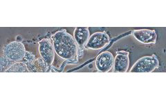 Veolia Anita Mox - Wastewater Treatment System