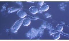 Veolia AnoxKaldnes - Moving Bed Biofilm Reactor (MBBR)