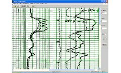 LogDigi - Automated Well Log Digitizing Software