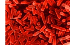 Legionella Risk Assessments