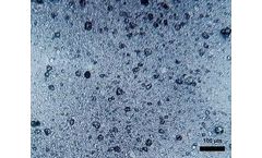 Types of Water Contaminants Found in Drinking Water Sources