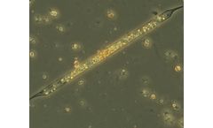 Maryland Tests Innovative Technology to Reduce HABs