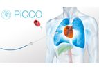 PiCCO Technology