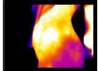 Thermographic Equipment for Medical and Veterinary Applications